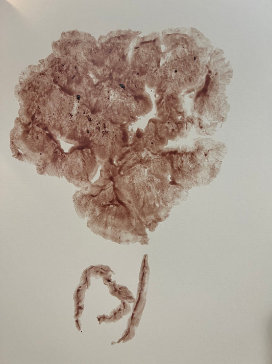 Placenta Print