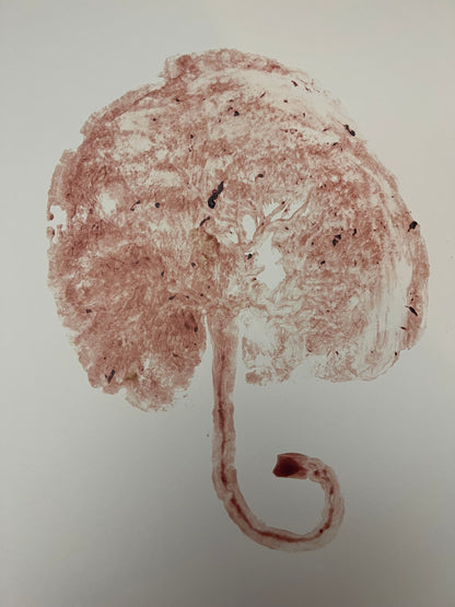 Placenta Print